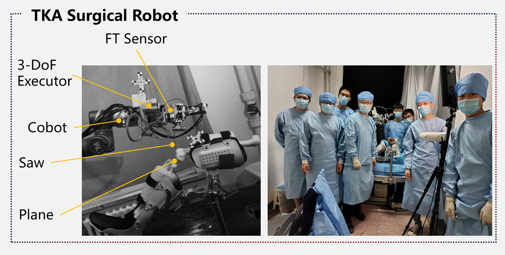 Bone Cutting Robot for TKA Surgery system overview